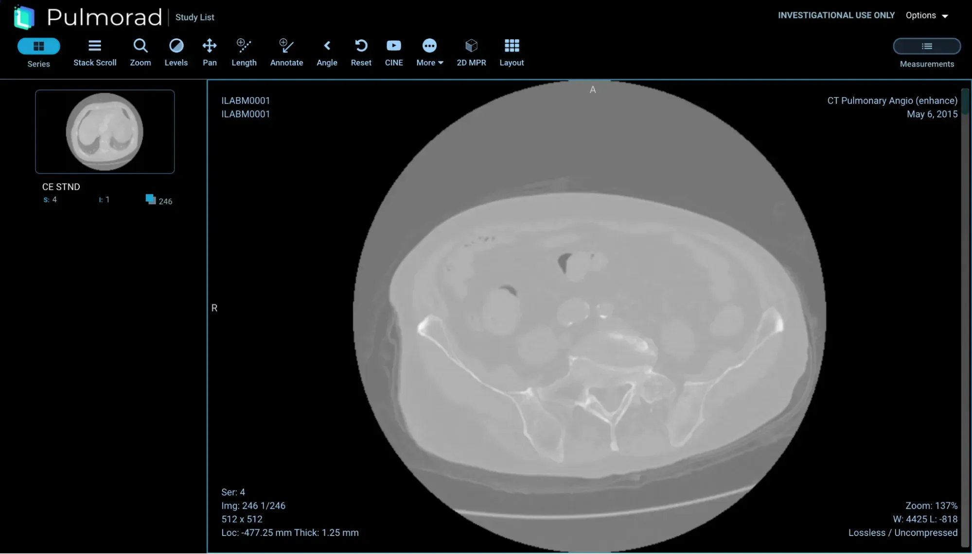 서울대학교병원 DICOM 뷰어 1