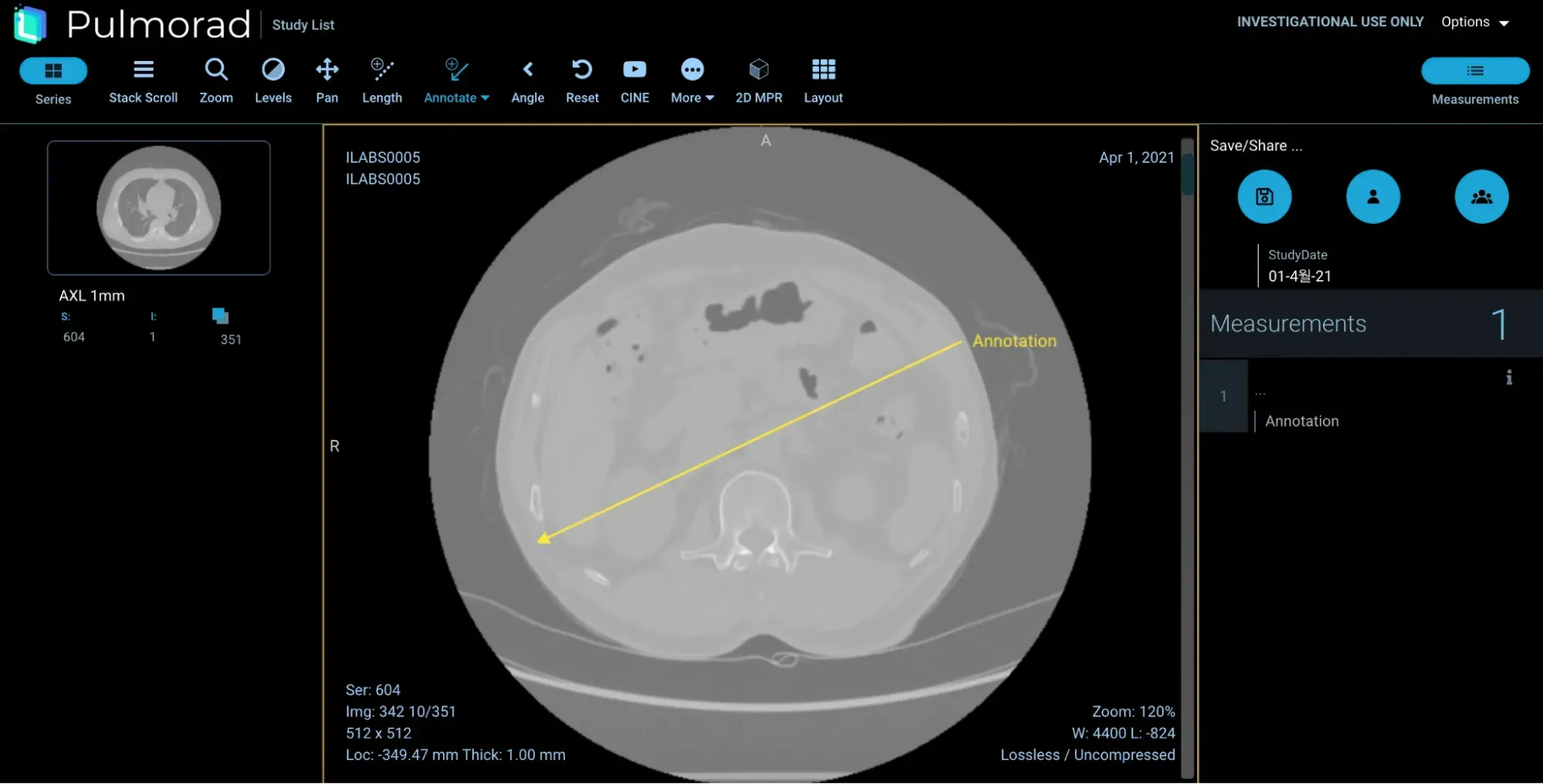 서울대학교병원 DICOM 뷰어 2